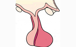 pituitary gland 02sm